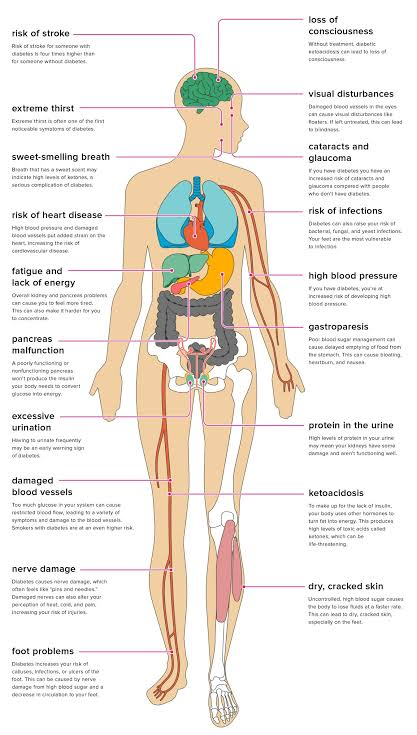 Complications of diabetes